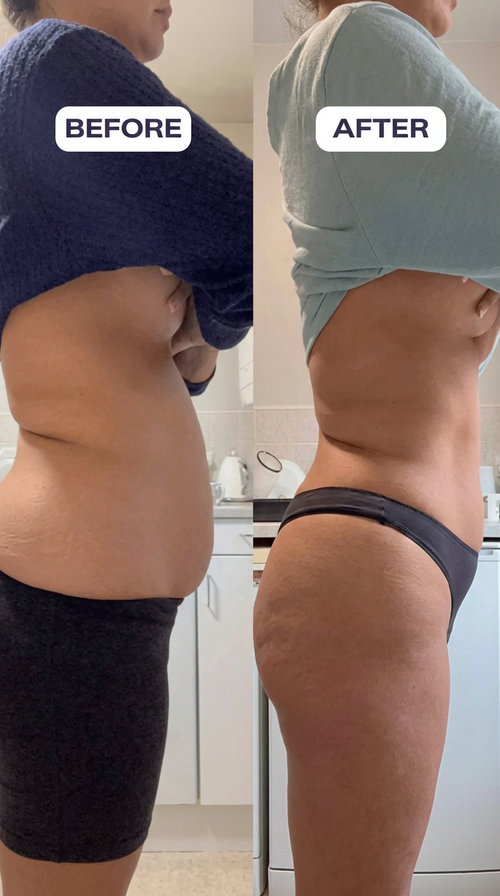Dimo Hapi Tumy - Gut Health & Digestion